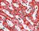 Autophagy