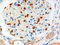 Forkhead Transcription Factors