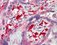 Inflammation