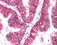 Protein Family Focus: ABC Transporters