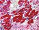 Solute Carrier Proteins
