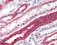 Ubiquitin ligases