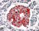 Voltage-gated Ion Channels