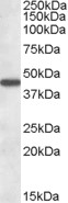 EB08259 1