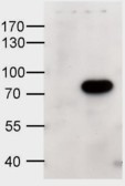 EB08708 1