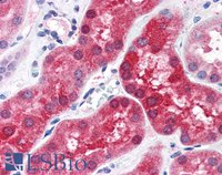 EB08070 1