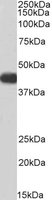 EB05674-B 1