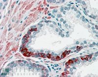 EB06536 3