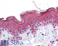 EB05382 3