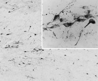 EB06725 1