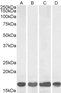 Goat Anti-AIF1 / IBA1 (isoform 1 and 3) Antibody