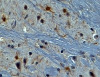 EB05419 5