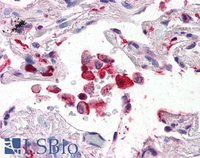 EB05419 2