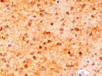 EB07174 2