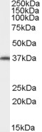EB07776 1