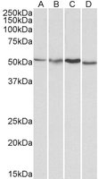 EB06562-T 1