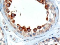 EB05881 1