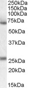 EB08777 1