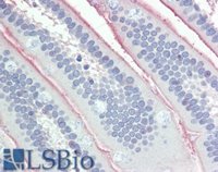 EB09017 1