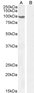 Goat Anti-Androgen Receptor Antibody