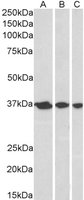 EB05345-T 1