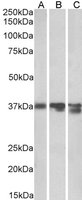 EB06795 2