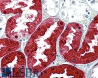 EB07697 2