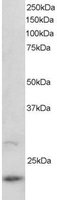 EB05545 1