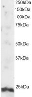 EB05549 1