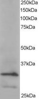 EB05433 2