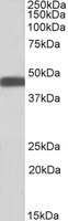 EB06745-T 1