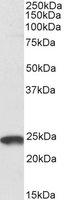 EB05291-T 1
