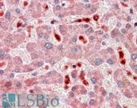 EB05291-T 2