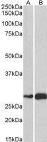 EB05246 2
