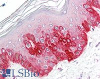 EB07893 2