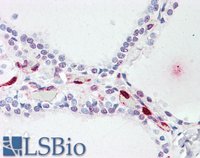 EB08261 2