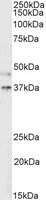 EB06118-T 1