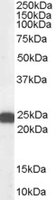 EB05167 1