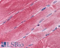 EB05486 3