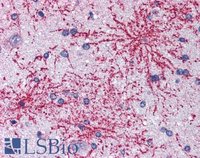 EB05177 2