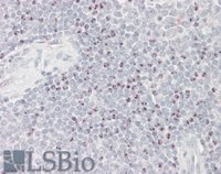 EB09033 1