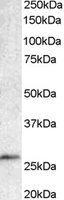 EB05006 1