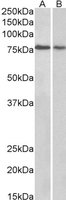 EB05868 1
