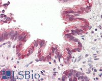 EB05760 1