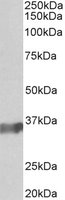 EB05676 1