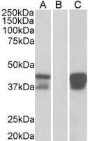 EB05676 2