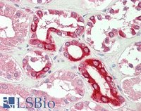 EB10361 1