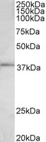 EB11742 1