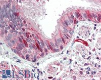 EB09526 2