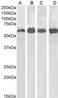 EB07282-T 1